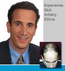 hair transplants
